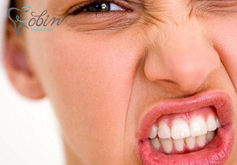 تاثیر استرس بر سلامتی دندان 
